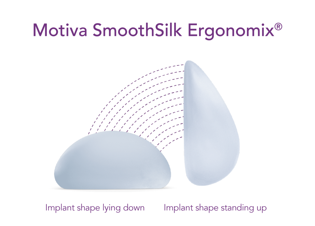 Infographic depicting Motiva SmoothSilk Ergonomix implant lying down and standing up
